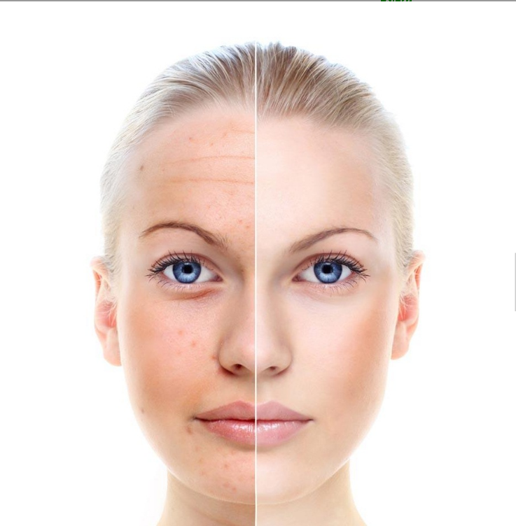 Topical Co-Enzyme Q10 Serum – Antioxidant Powerhouse